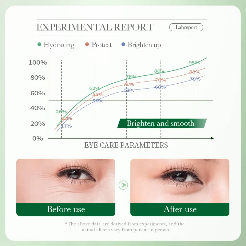 Centella Asiatica Eye Cream Mo - đánh giá và giá Beauty Huda Makeup
