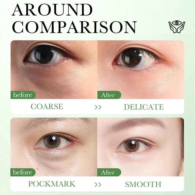 Centella Asiatica Eye Cream Mo - đánh giá và giá Beauty Huda Makeup