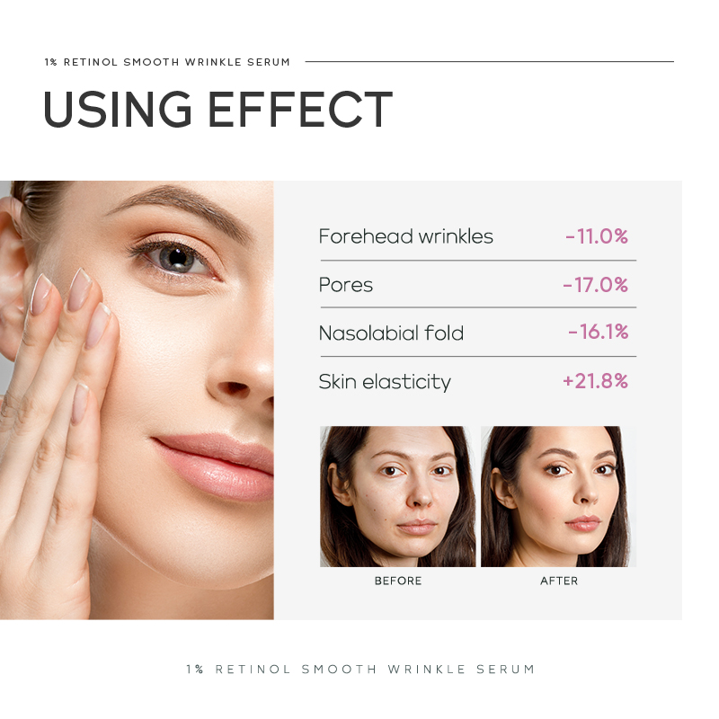 Quiyum 1% Retinol Smooth Wrink - đánh giá và giá The Ordinary Serum Hyaluronic Acid